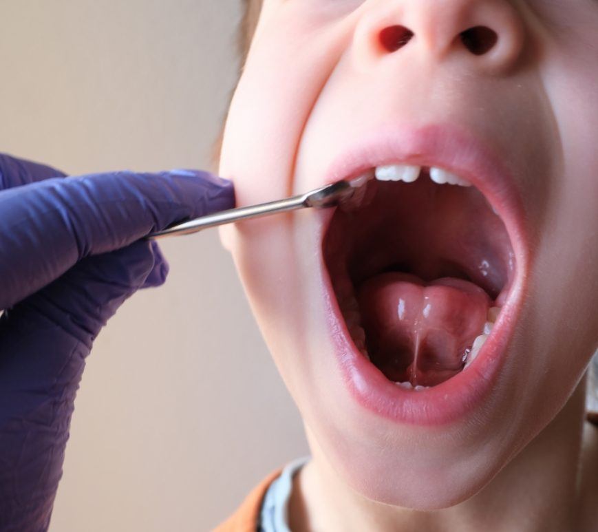 Dentist examining a childs mouth